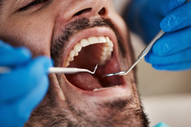 Best Teeth Whitening  in Campbell, OH